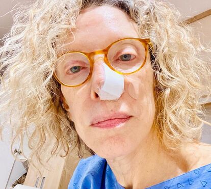 Marília Gabriela confunde borbulha com cancro e alerta: 'Usem protetor solar até dentro de casa, sempre'