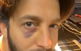 Salvador Sobral surge com olho negro no primeiro concerto do novo disco