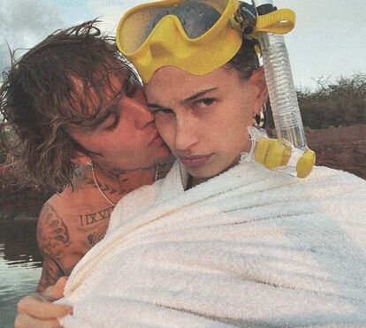 Hailey, a mulher de Justin Bieber, revela que teve um coágulo no cérebro... que lhe podia ter causado a morte