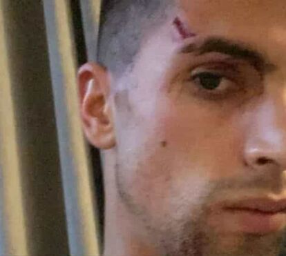 Futebolista João Cancelo agredido e roubado em crime violento à porta de casa