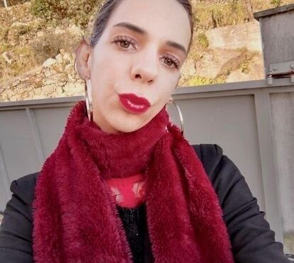 Alexa, ex-‘Ídolos’, hospitalizada após ataque de cariz homofóbico