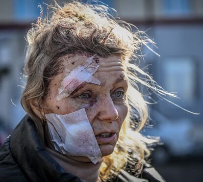 Professora de 52 anos diz ter sido salva por 'anjo da guarda' de ataque míssil da Rússia