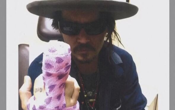 Johnny Depp depois de ter sido atendido por um ferimento na ponta do dedo