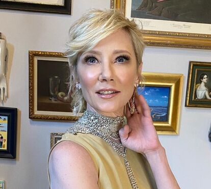 Atriz Anne Heche está em estado muito grave após carro que conduzia ter embatido violentamente contra uma casa