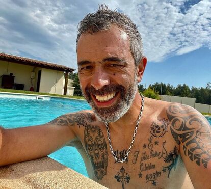 Pedro Alves de 'Festa é Festa' sofre acidente e fica sem dedo numa das mãos