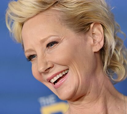 Atriz Anne Heche está em morte cerebral após aparatoso acidente após ter consumido cocaína 