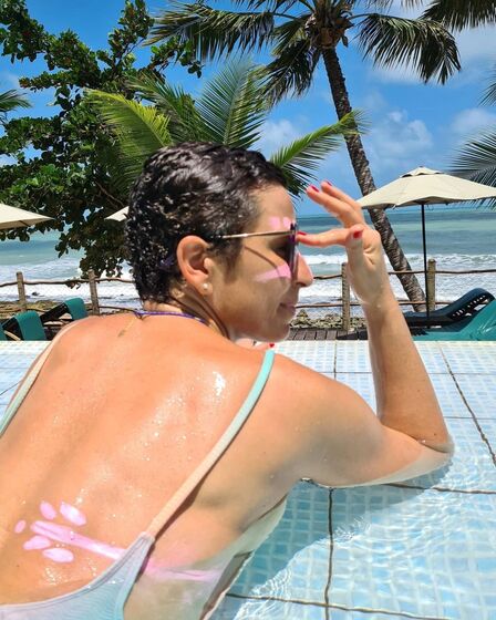 Joana passou mostrou aos seguidores a cicatriz que a cirurgia deixou, com uma mensagem: "Marcas da batalha vencida. A operação que me puxou músculo das costas para a frente deixou uma cicatriz que merece honras de protetor cor de rosa"