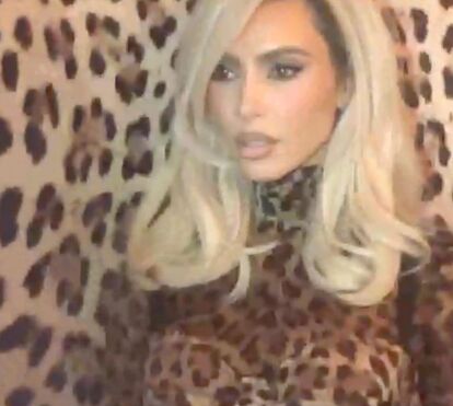 Kim Kardashian, que sofre de psoríase, revela que filho tem vitiligo 