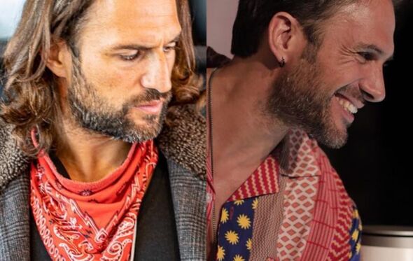 José Fidalgo, antes e depois da cirurgia