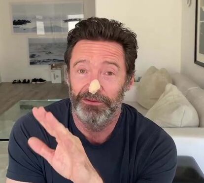 Hugh Jackman receia ter novo cancro de pele e deixa aviso: 'Não vale a pena arriscar, por muito que queiram ficar bronzeados'