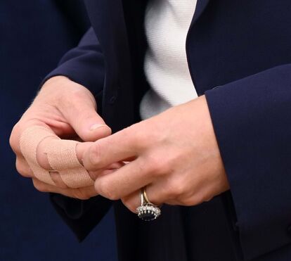 Direto de Londres: 'Tudo sugere que Kate Middleton sofre de cancro do cólon'