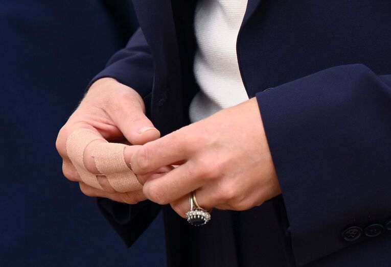 Kate Middleton, lesão, mão