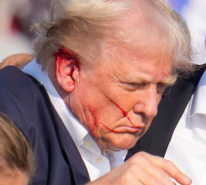 Choque! Trump reage à tentativa de assassinato: 'Imediatamente senti a bala a rasgar a minha pele'