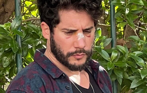 Ricardo Sá, agredido