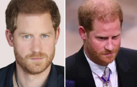 Implantes capilares ou photoshop? Novo visual do príncipe Harry dá que falar
