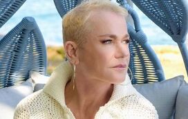 Xuxa revela que sofre de alopecia genética