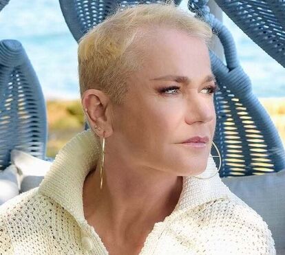 Xuxa revela que sofre de alopecia genética