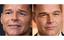 Segredo desvendado! Ricky Martin reaparece como se tivesse 20 anos e nós contamos o que é que o cantor fez à cara
