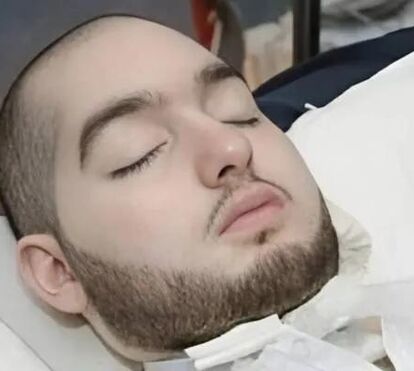 Terminou o drama! Morreu o 'príncipe adormecido'