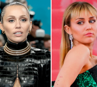 O que se passa com o rosto de Miley Cyrus? Cirurgião plástico confirma que a estrela fez vários retoques