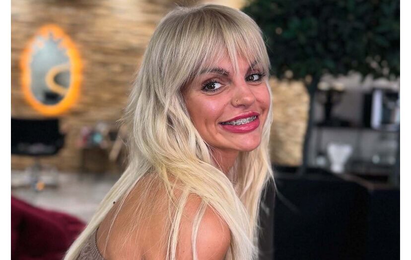 Amiga defende Fanny Rodrigues de críticas sobre o seu corpo, apelando à empatia nas redes sociais