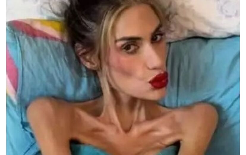 Influencer morre na busca pelo corpo perfeito; Nihal Candan tinha 30 anos