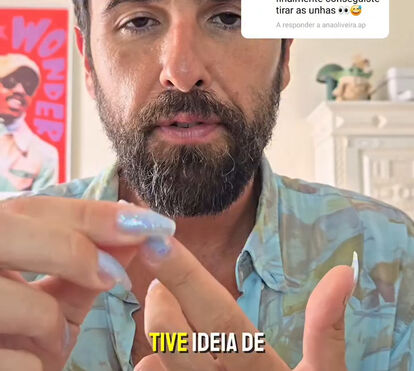 Cuidado com a cola que usa para as unhas postiças! Veja o exemplo do Rodrigo Gomes