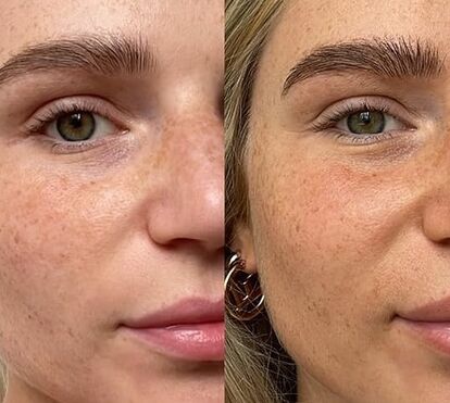 As gotas autobronzeadoras para o rosto que fazem mesmo a diferença e dão boa cara todo o ano