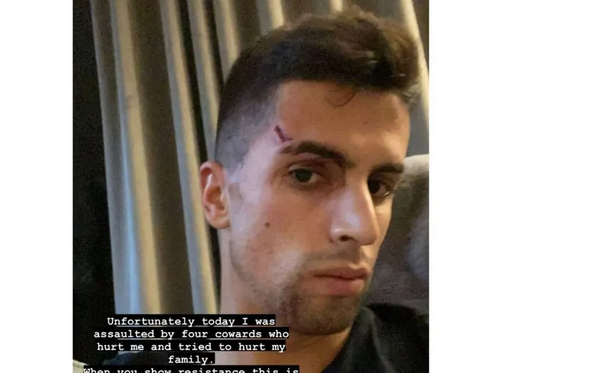 Cancelo foi alvo de assalto em casa