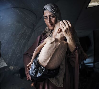 Fome em Gaza
