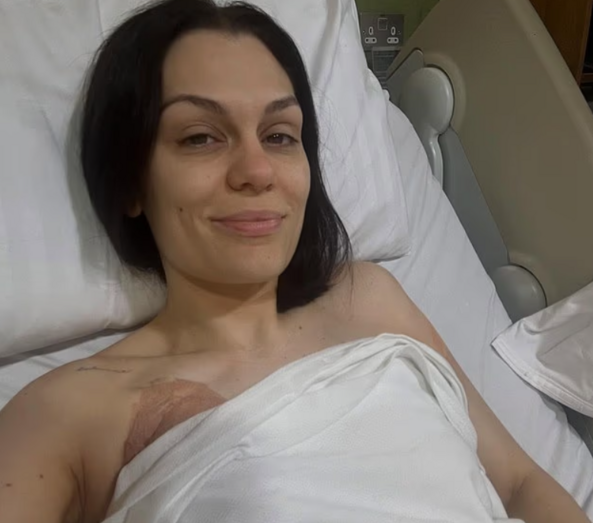 Jessie J enfrenta novo problema de saúde após cirurgia para tratar cancro na mama