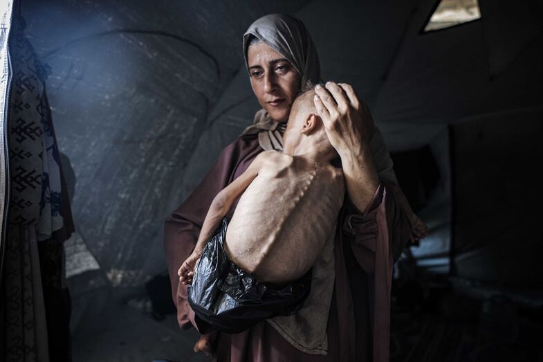 Gaza: Mãe segura criança desnutrida, símbolo da crise humanitária