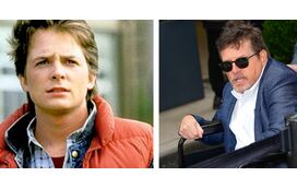 "Dói vê-lo assim!" Michael J.Fox reaparece e o seu estado provoca grande preocupação