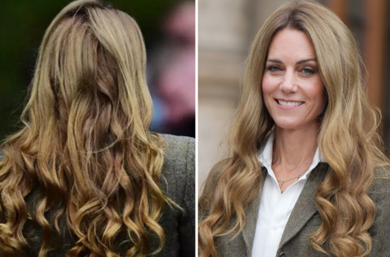 Kate Middleton surge com novo visual, levantando preocupações sobre a sua saúde