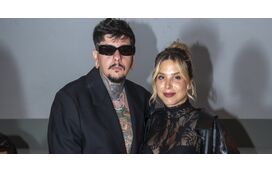 Agir e Catarina Gama não querem saber sexo do bebé: "Estamos a deixar tudo para a última hora"
