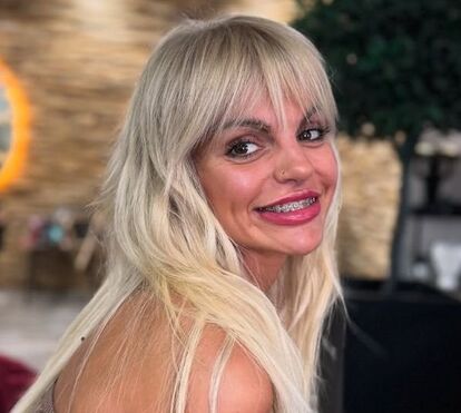 Dramas não acabam: Cozinha a arder e o teto que cedeu. Fanny relata estragos em casa