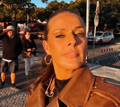 Após susto de saúde, Micaela submete-se a operação plástica que era um sonho antigo