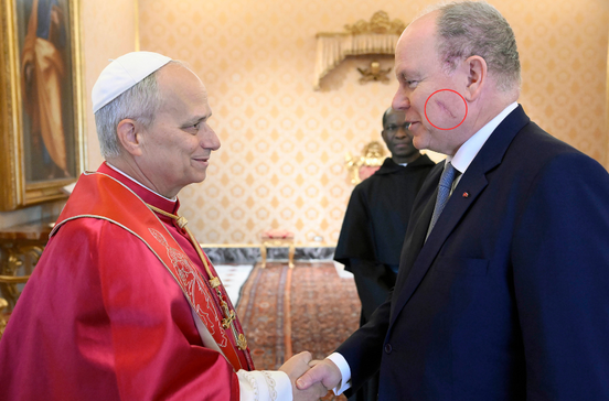 Príncipe Alberto visita o Papa no Vaticano após cirurgia recente