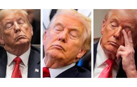 Comportamentos bizarros, hematomas nas mãos, pés a arrastar e sono profundo em público! O que se passa, de verdade, com Donald Trump?