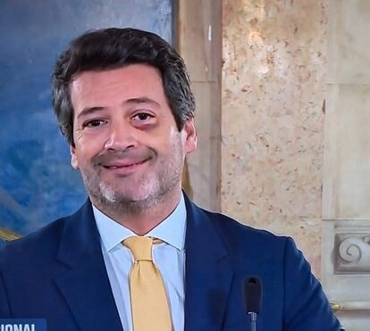 Acidente ou agressão? A estranha explicação de André Ventura para o olho negro