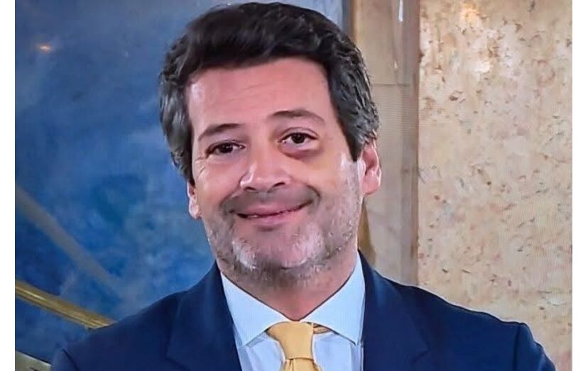 André Ventura surge com um olho negro