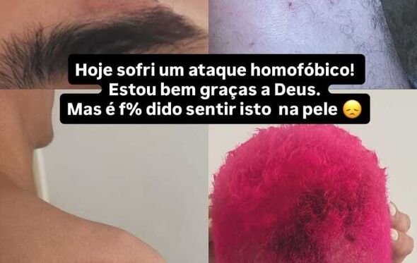 O resultado da alegada agressão a Luís Borges