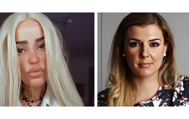 Romana não cala a indignação e sai em defesa de Ruth Marlene: "Magoaram-na"
